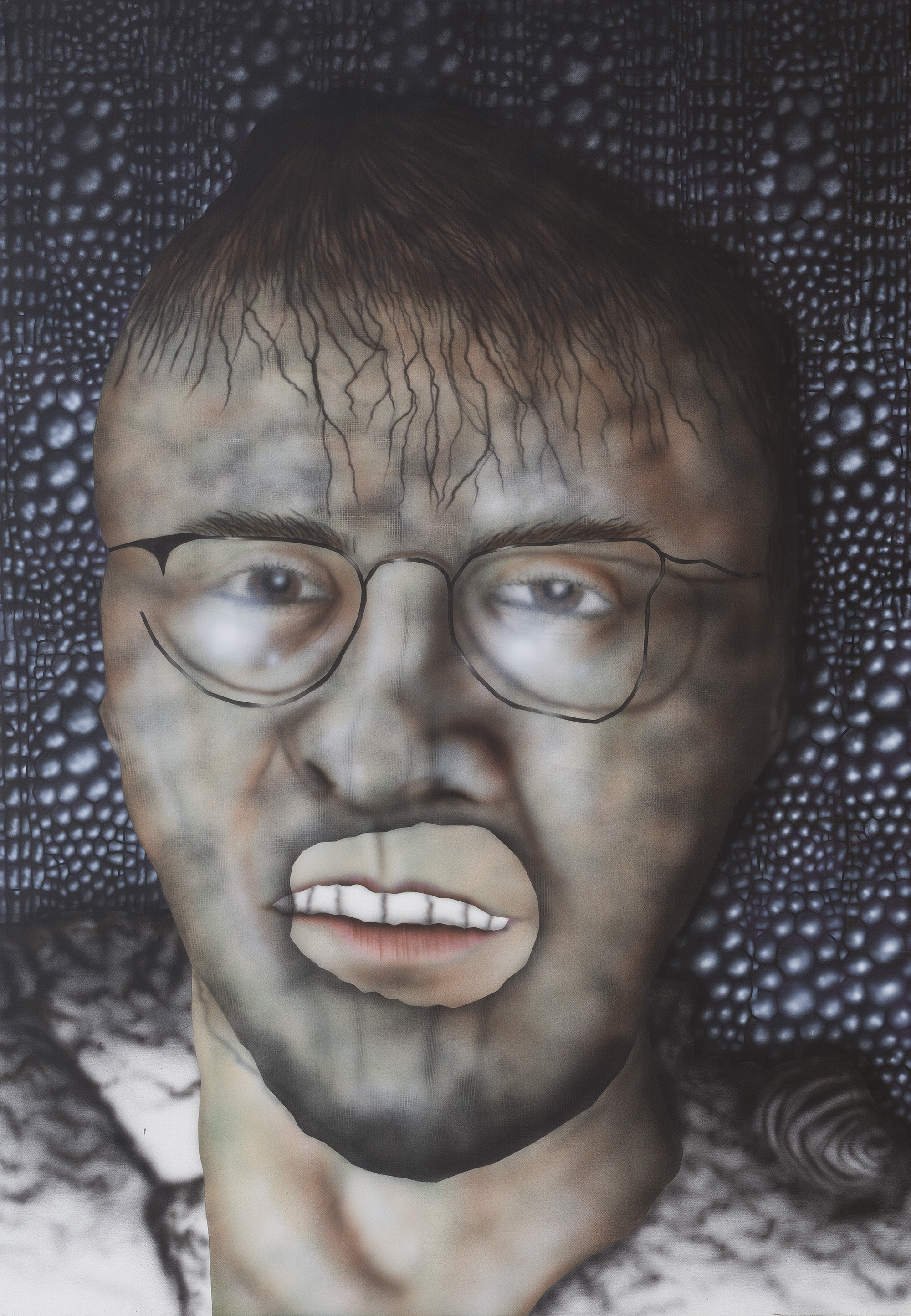 A heavy, hard-to-conceal mark of poverty (2)